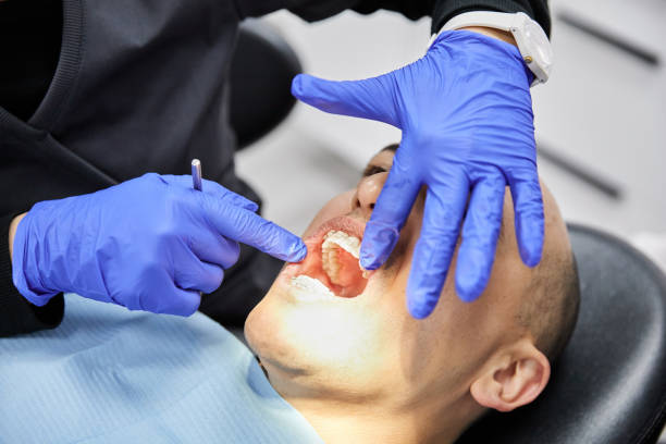 Best Emergency Dentist for Knocked-Out Tooth in Manchester, MO